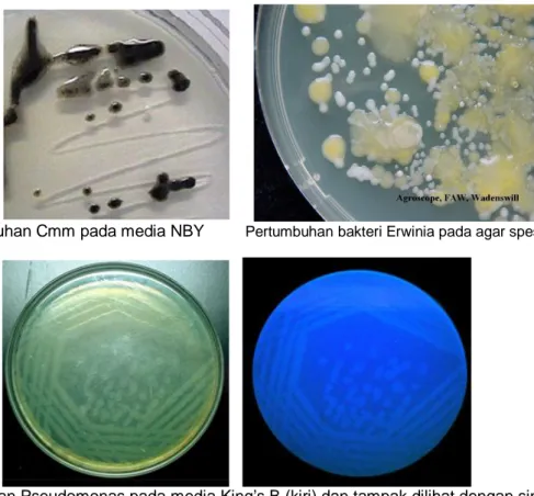 Gambar 4.  Pertumbuhan bakteri pada berbagai media agar (Padil, 2008) 
