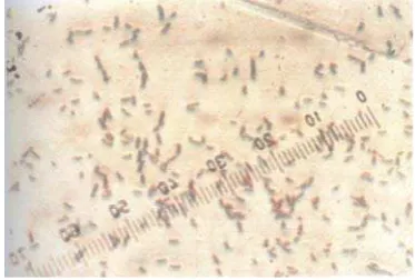 Gambar 1 : Hasil isolasi Bakteri Alcaligenes sp 