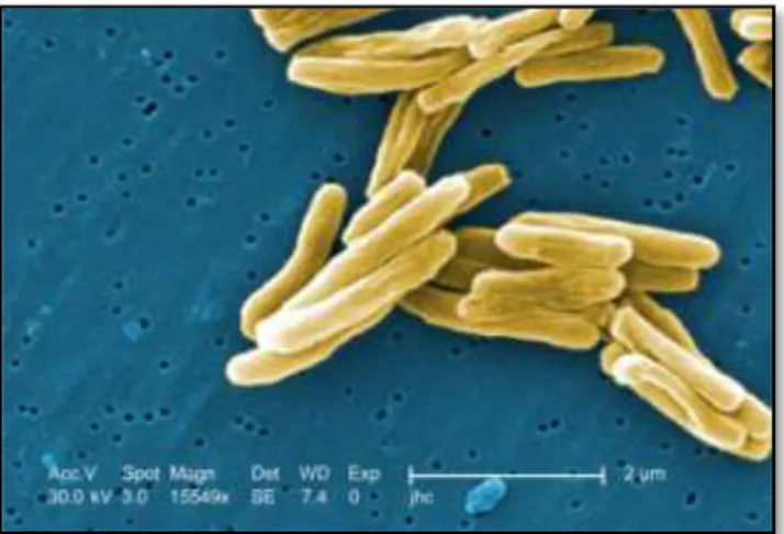 Gambar 2.3. Gram-positif Mycobacterium tuberculosis (Bryan, 2015)  M.  tuberculosis  berbentuk  batang  lurus  atau  sedikit  melengkung,  tidak 