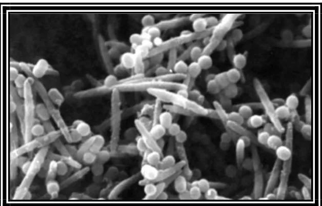Gambar 2. Agregasi F.nucleatum (bentuk batang)   dan P.gingivalis (bentuk kokus) dengan scanning  electron micrograph  5 