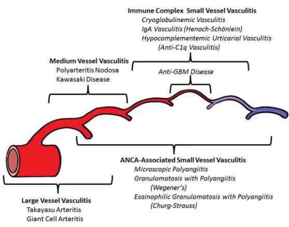 Gambar 2. Distribusi keterlibatan pembuluh darah oleh vaskulitis pembuluh darah besar, pembuluh darah sedang, dan pembuluh darah kecil