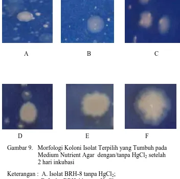 Gambar 9.   Morfologi Koloni Isolat Terpilih yang Tumbuh pada                       Medium Nutrient Agar  dengan/tanpa HgCl2 setelah                      2 hari inkubasi   