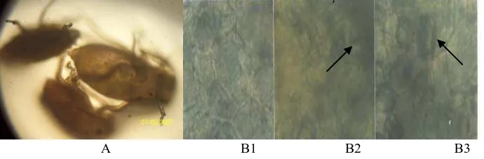 Gambar  1.  A: Aphid; B1: Jaringan daun sehat; B2, B3: Badan Inklusi Tanaman Bergejala Mosaik  
