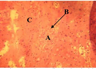 Gambar 4. Gambaran Mikroskopis Sel Ginjal Tikus pada Kelompok Dosis 1000 mg/kg bobot badan dengan Pewarnaan HE (Hematoksilin Eosin) dengan perbesaran 400x
