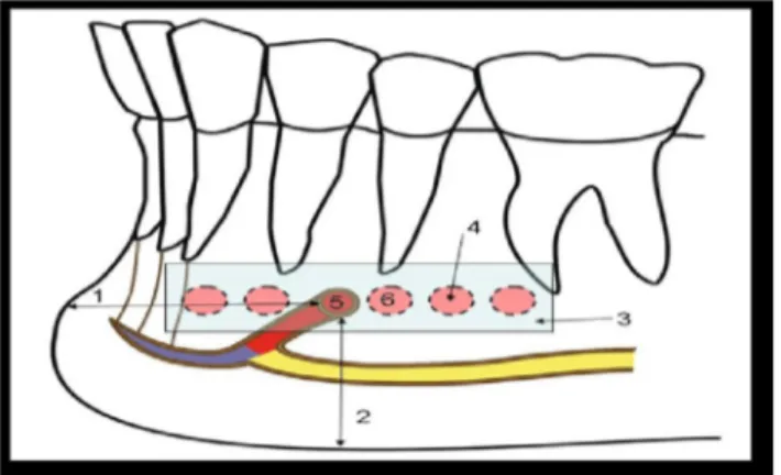 Gambar 2.4 Anatomi variasi posisi foramen mental pada bidang horizontal dalam hubungannya   dengan akar gigi (Sumber :Juodzbalys G, Wang HL, Sabalya G