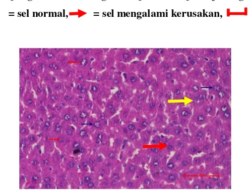 Gambar 5.Hasil pengamatan histologi sel hepar kelompok uji dengan pewarna HE 