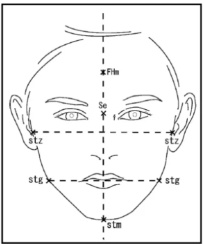 Gambar 6. Pengukuran foto frontal wajah7 