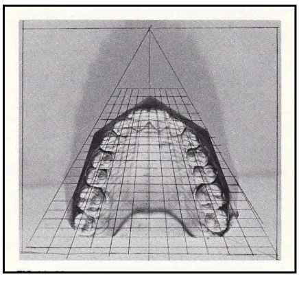 Gambar 7. Symmetrograph 23