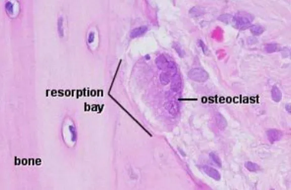 Gambar 3  Osteoklas, Howslip’ lacuna atau resorption bay (Caceci 2007)  Setiap osteoklas melalui proses enzimatik kemudian mendepres bagian  matriks yang disebut Howslip’s lacuna atau resorption bay (Gambar 3)