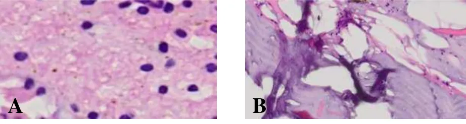 Gambar 3. Histopatologi daging dan hati ikan Kakap Putih (Lates calcarifer) 