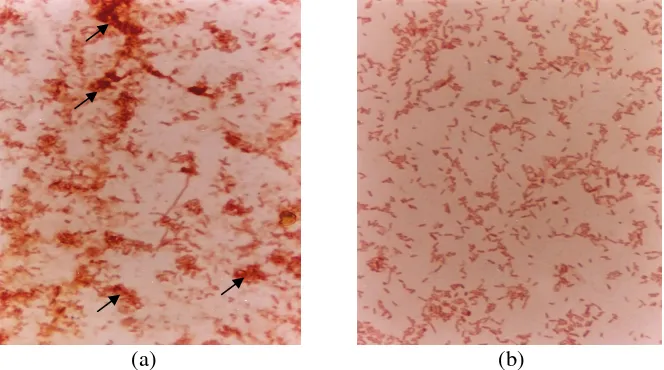Gambar 11.  Hasil uji aglutinasi terhadap Salmonella thphimurium  (pembesaran 40x) (a) Penggunaan PM dari BIS; (b) Kontrol 