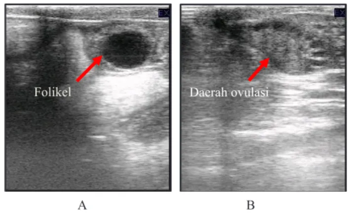 Gambar 1.   Gambaran ultrasonography folikel dominan yang  mengalami ovulasi 12 jam setelah estrus berakhir