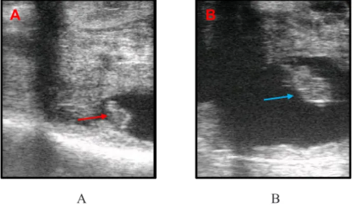 Gambar 2.  Hasil pemeriksaan kebuntingan pada sapi perla- perla-kuan menggunakan USG. Embrio umur 30 hari  (panah merah, A) dan embrio umur 40 hari (panah  biru, B)