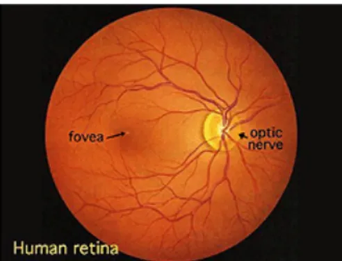 Gambar 4 . optic nerve head atau optic disc. (sumber : Kansky J.J. 2007). 