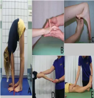 Gambar 3. A) menyentuh lantai dengan kedua telapak  tangan B) ekstensi sendi metacarpophalangeal jari kelima   C) abduksi ibu jari ke lengan bawah D) hiperekstensi siku  E) hiperekstensi lutut
