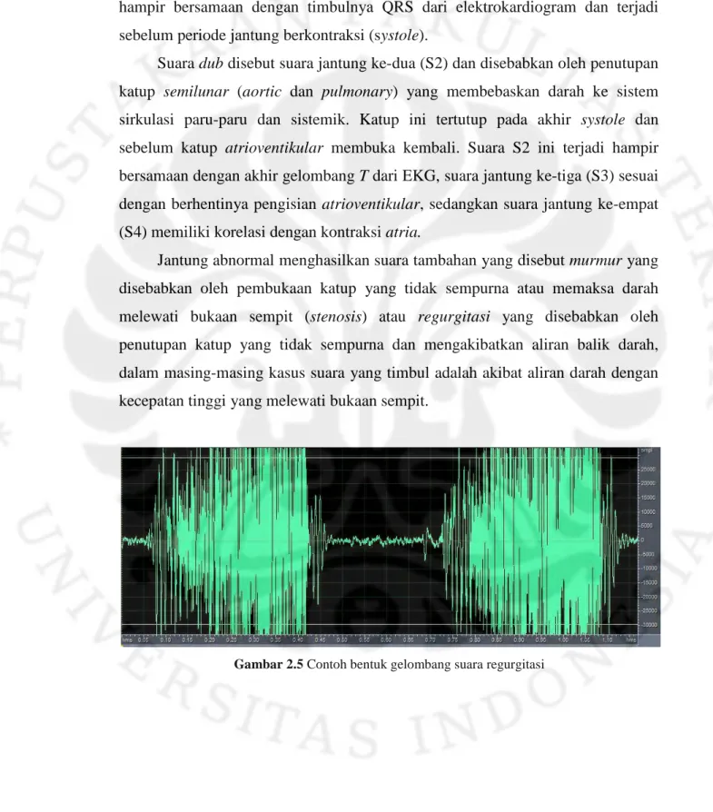 Gambar 2.5 Contoh bentuk gelombang suara regurgitasi 