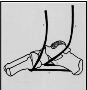 Gambar  2.  Struktur  pendukung  pada  arkus  longitudinal  medial:  1)tibialis  anterior,  2)tibialis  posterior, 3)ligamen spring, 4)plantar aponeurosis  Sumber:  Franco, 1987 
