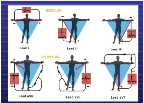 Gambar 2. 2 Augmented Limb Lead (Penney, 2003)