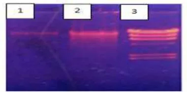 Figure 2. Results of electrophoresis of total  DNA by using UV transluminator 