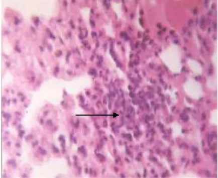 Figure 4. Black arrow shows focused  infiltration mononuclear cells in mice’s liver stained with HE (zoomed 10 x 40) 