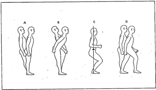 Gambar 2.3 Strategi postural reaktif A. Strategi pergelangan kaki, B. Strategi pinggul, C