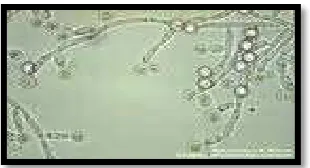 Gambar 1. Candida albicans50