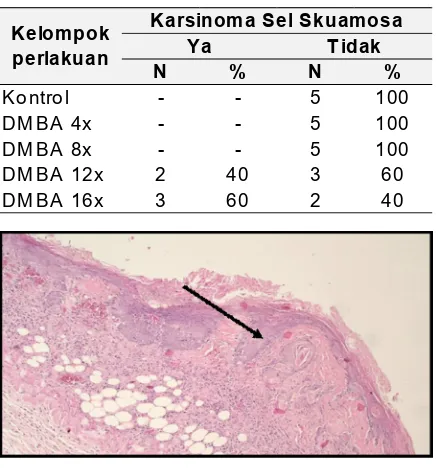 Tabel 4. Sebaran karsinoma sel skuamosa menurutkelompok perlakuan