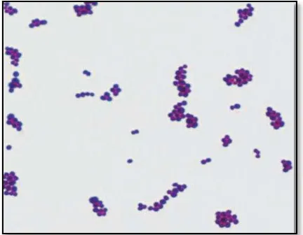 Gambar 3. Staphylococcus aureuslempeng  pada Blood Agar.26 