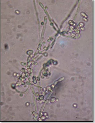 Gambar 4. Candida albicans26  