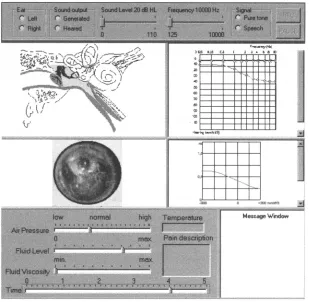 Figure 4.1 Simulation of middle ear disease