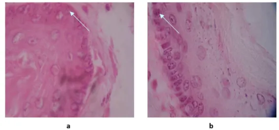 Gambar 2. Gambaran bronkus tikus dengan pengecatan Hematoksilin Eosin dalam  perbesaran 10 x 40