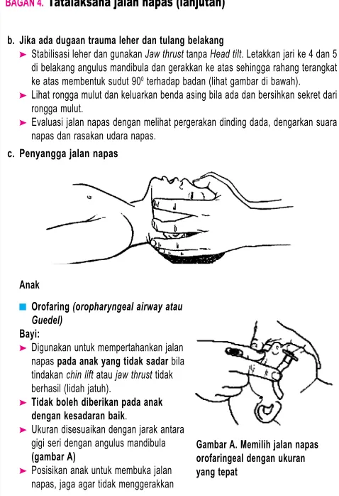 Gambar A. Memilih jalan napas 