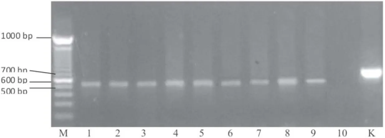Gambar 2 :Hasil amplifikasi DNA T gondii pada ayam buras dengan primer BAG1. Keterangan : M