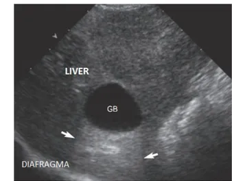 Gambar 3 Sonogram kantung empedu normal pada kucing; GB, gallbladder (kantung empedu) (Kealy 2011)