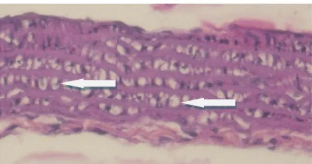 Gambar  2.  Gambaran  mikroskopik  potongan  melintang  aorta  tikus  wistar  dengan  diet  pelet  lemak  babi  selama  14  hari  (kelompok  II)  dengan  pembesaran  20  x  10