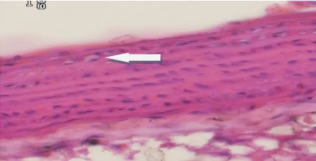 Gambar  4.  Gambaran  mikroskopik  potongan  melintang  aorta  tikus  wistar  dengan  diet  pelet  lemak  babi  selama  14  hari  dan  dilanjutkan  dengan pemberian  ekstrak daun pepaya selama  14 hari (kelompok IV) dengan pembesaran 40 x  10