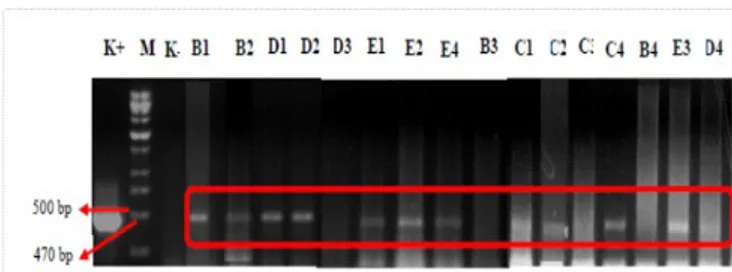 Tabel   3.   Jumlah   dan   presentase   plantlet   tebu   PRG  overekspresi   gen  SoSPS1  dan    SoSUT1  yang   lolos  seleksi Event Σ Tan