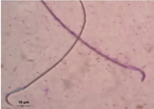 Gambar 1. Preparat viabilitas spermatozoa dengan pewarnaan eosin nigrosin. Spermatozoa mati (a), Spermatozoa hidup (b) (Perbesaran 1000x)