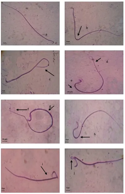 Gambar 2. Morfologi spermatozoa tikus dengan pewarnaan giemsa 10%. Spermatozoa normal (a), ekor menggulung (d dan f), bagian tengah melekuk (b, c, e, dan h), kepala terlipat (i dan j) (Perbesaran 1000x)
