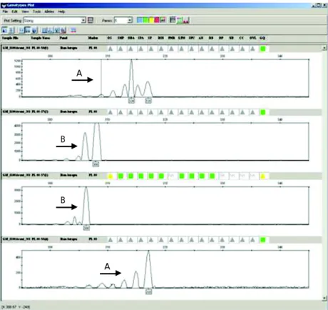Gambar 2. Hasil separasi PCR produk ikan kerapu sunu, P. leopardus dengan primer PL-08 menggunakan ABI 3100 Aviant Genetic Analyzer (A