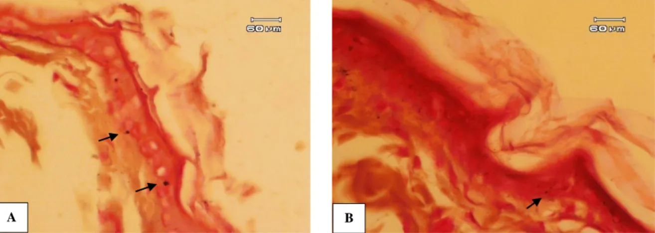 Gambar  1.  Gambaran  mikroskopik  kulit  tikus  wistar  kelompok  A    (kontrol  negatif)