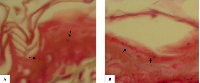 Gambar  4.  Gambaran  mikroskopik  kulit  tikus  kelompok  D  (perlakuan  3)  yang diterminasi  hari  ke-21