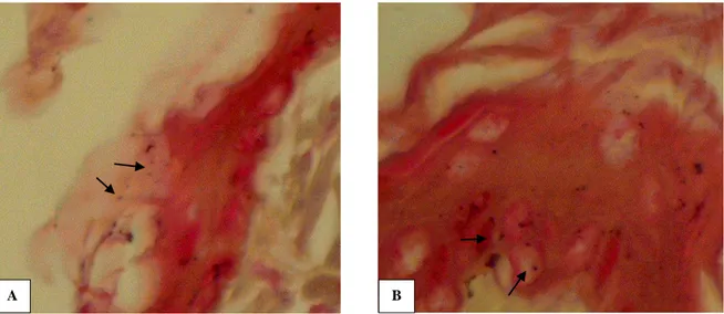 Gambar 5. Gambaran mikroskopik kulit tikus kelompok D (perlakuan 3) yang diterminasi hari ke-31