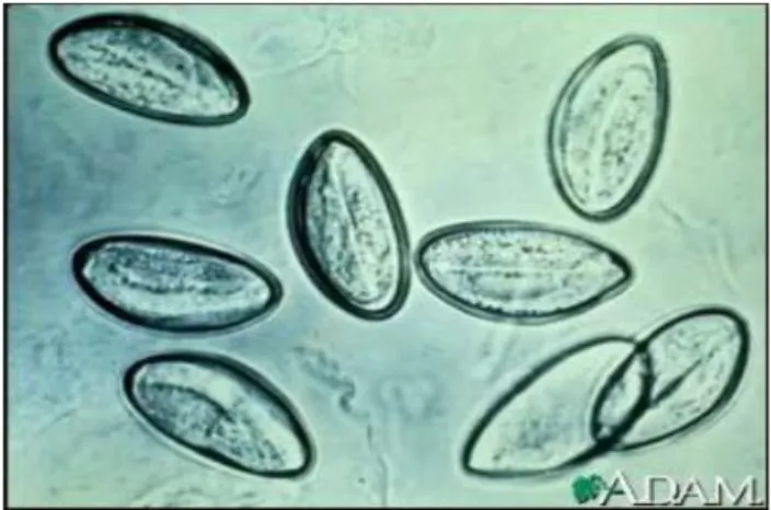 Gambar 2.2. Telur E.vermicularis 