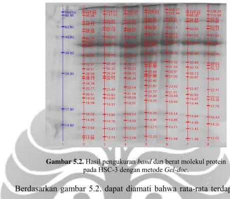 Gambar 5.2. Hasil pengukuran band dan berat molekul protein 