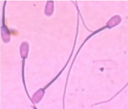 Gambar 2 Spermatozoa dengan pewanaan Williams. Sumber : Riyadhi et al. (2012). 