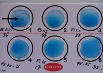 Gambar 1. Reaksi positif E. coli O157 pada latex agglutination test. Tanda panah (→)                         menunjukkan hasil reaksi aglutinasi dari isolat FS.KS.36
