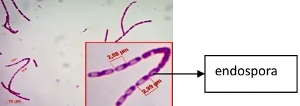 Gambar 2.   Hasil elektroforesis dari amplifikasi 16S rRNA isolat bakteri endofit kulit batang  (KC)  tanaman cengkeh dengan ukuran pita DNA ± 1324 bp