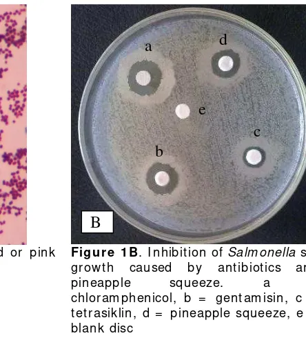Figure 1A. Gram negative bacteria (red or pink 