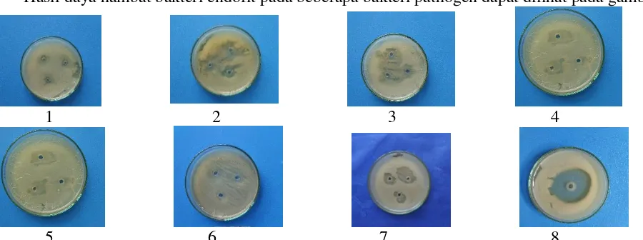 Tabel 3 : Media, bakteri endofit dan daya hambat pada bakteri pathogen 
